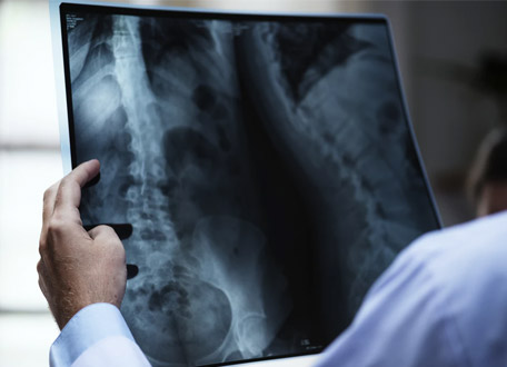 Are you at risk of injuring yourself?